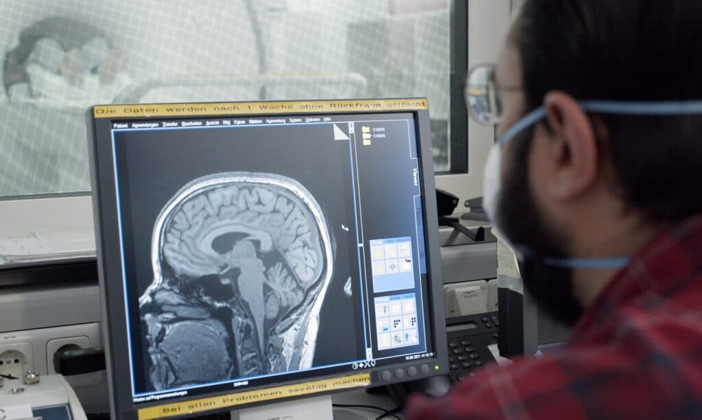 Resonancia magnética para anticiparse a las distracciones